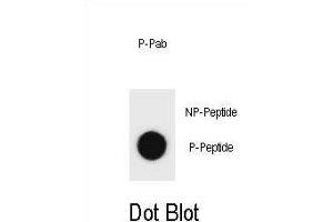 Dot blot analysis of beclin 1 Antibody (Phospho S64) Phospho-specific Pab (ABIN1881111 and ABIN2839947) on nitrocellulose membrane. (Beclin 1 antibody  (pSer64))