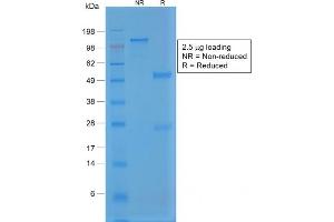 SDS-PAGE Analysis Purified Rabbit Recombinant Monoclonal Antibody (VWF/1859R). (Recombinant VWF antibody  (AA 1815-1939))