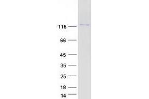 Validation with Western Blot (MAMDC4 Protein (Myc-DYKDDDDK Tag))