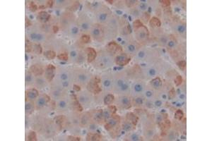 IHC-P analysis of liver tissue, with DAB staining. (GUCY1B3 antibody  (AA 408-619))