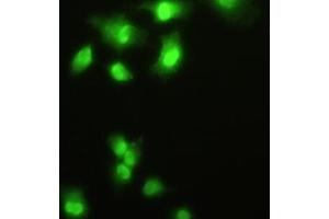 Detection of HDGF in A549 cells using Polyclonal Antibody to Hepatoma Derived Growth Factor (HDGF) (HDGF antibody  (AA 10-240))