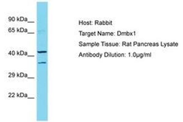 DMBX1 antibody  (AA 191-240)