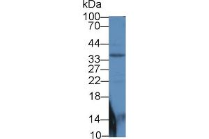 Western blot analysis of Mouse Pancreas lysate, using Human Smad6 Antibody (2 µg/ml) and HRP-conjugated Goat Anti-Rabbit antibody ( (SMAD6 antibody  (AA 261-495))