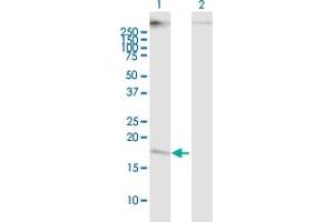 Western Blot analysis of CMTM5 expression in transfected 293T cell line ( H00116173-T01 ) by CMTM5 MaxPab polyclonal antibody. (CMTM5 antibody  (AA 1-156))