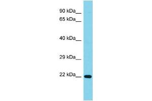 Host: Rabbit Target Name: C1orf158 Sample Type: Jurkat Whole Cell lysates Antibody Dilution: 1. (C1ORF158 antibody  (N-Term))