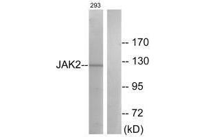 Western blot analysis of extracts from 293 cells, treated with etoposide (25uM, 24hours), using JAK2 (Ab-570) antibody. (JAK2 antibody  (Tyr570))