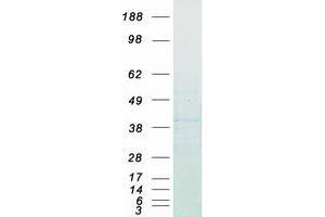 Validation with Western Blot (Cyclin D1 Protein (CCND1) (Myc-DYKDDDDK Tag))