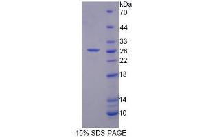 SDS-PAGE analysis of Human RFC4 Protein. (RFC4 Protein)