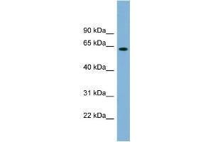 WB Suggested Anti-SLFN12 Antibody Titration: 0. (SLFN12 antibody  (Middle Region))