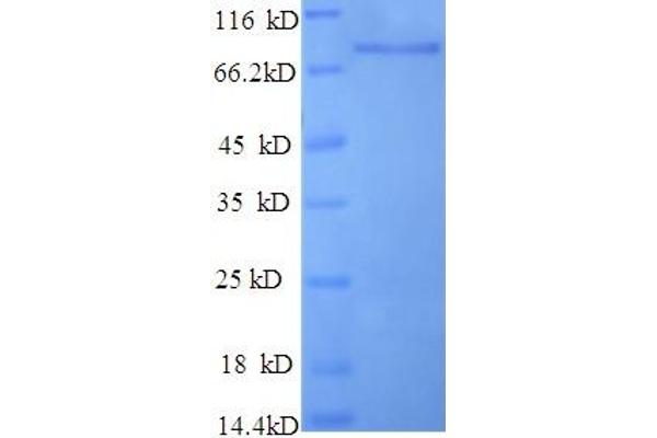 BCAS1 Protein (AA 1-584, full length) (His tag)