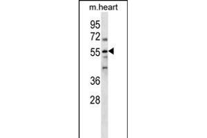 RP2 Antibody (N-term) (ABIN656199 and ABIN2845521) western blot analysis in mouse heart tissue lysates (35 μg/lane). (PARP2 antibody  (N-Term))