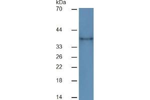 Western Blotting (WB) image for Cathepsin K (CTSK) ELISA Kit (ABIN6574151)