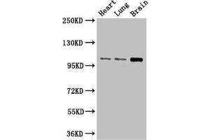 Western Blot Positive WB detected in: Mouse heart tissue, Mouse lung tissue, Mouse brain tissue All lanes: RBM10 antibody at 3 μg/mL Secondary Goat polyclonal to rabbit IgG at 1/50000 dilution Predicted band size: 104, 95, 111 kDa Observed band size: 104 kDa (RNA Binding Motif Protein, Y Chromosome (RBMY) (AA 501-700) antibody)