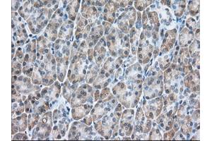 Immunohistochemical staining of paraffin-embedded Human colon tissue using anti-USP5 mouse monoclonal antibody. (USP5 antibody)