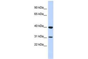 Image no. 1 for anti-Zinc Finger Protein 660 (ZNF660) (N-Term) antibody (ABIN6742930) (ZNF660 antibody  (N-Term))