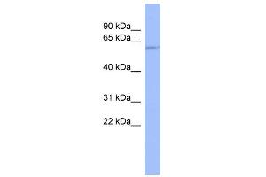 WB Suggested Anti-TPTE Antibody Titration:  0. (TPTE antibody  (Middle Region))