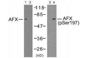 Western blot analysis of extracts from 293 cells using AFX (Ab-197) antibody (E021162, Lane 1 and 2) and AFX (phospho-Ser197) antibody (E011137, Lane 3 and 4). (FOXO4 antibody  (pSer197))