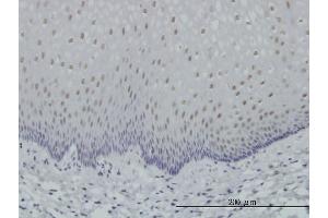 Immunoperoxidase of monoclonal antibody to RARA on formalin-fixed paraffin-embedded human esophagus. (Retinoic Acid Receptor alpha antibody  (AA 315-424))