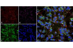 Immunocytochemistry (ICC) image for anti-Solute Carrier Family 17 (Vesicular Glutamate Transporter), Member 7 (SLC17A7) (AA 493-560) antibody (ABIN1027710)