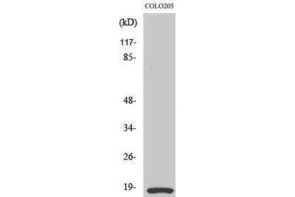 MYL12B antibody  (Ser1179)