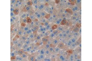 Used in DAB staining on fromalin fixed paraffin- embedded liver tissue (CHGB antibody  (AA 448-664))