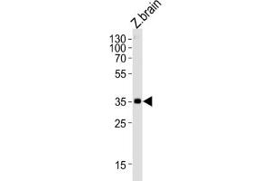 Western Blotting (WB) image for anti-Guanine Nucleotide Binding Protein (G Protein), beta Polypeptide 1 (GNB1) antibody (ABIN3004745) (GNB1 antibody)