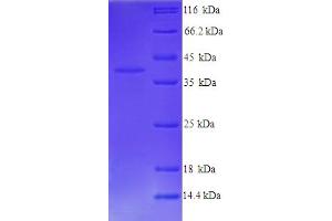 SDS-PAGE (SDS) image for Wingless-Type MMTV Integration Site Family, Member 3 (WNT3) (AA 22-355) protein (His tag) (ABIN5713948) (WNT3 Protein (AA 22-355) (His tag))