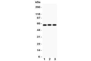 Western blot testing of Perforin antibody and Lane 1:  HeLa (Perforin 1 antibody  (AA 175-555))