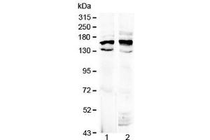 Western blot testing of 1) rat brain and 2) mouse brain lysate with Formin antibody at 0. (FMN1 antibody  (AA 1195-1419))