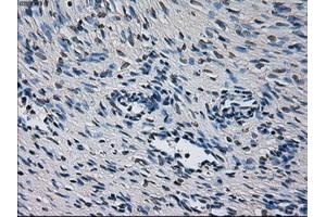 Immunohistochemical staining of paraffin-embedded liver tissue using anti-CYP2E1 mouse monoclonal antibody. (CYP2E1 antibody)