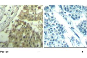 Image no. 1 for anti-Cyclin-Dependent Kinase 1 (CDK1) (Tyr19) antibody (ABIN319405) (CDK1 antibody  (Tyr19))