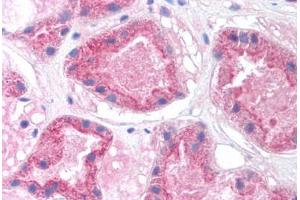 Human Kidney (formalin-fixed, paraffin-embedded) stained with HNF4A antibody ABIN214775 at 5 ug/ml followed by biotinylated goat anti-rabbit IgG secondary antibody ABIN481713, alkaline phosphatase-streptavidin and chromogen. (HNF4A antibody  (N-Term))