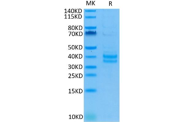 EpCAM Protein (AA 24-265) (His tag)