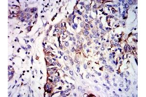 Immunohistochemistry (IHC) image for anti-Glutathione S-Transferase mu 1 (GSTM1) antibody (ABIN969181)