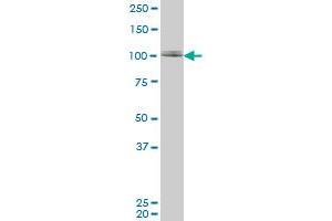 ZNF281 monoclonal antibody (M02), clone 1C9. (ZNF281 antibody  (AA 787-893))