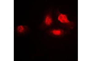 Immunofluorescent analysis of UBA2 staining in A549 cells. (UBA2 antibody  (C-Term))