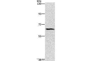 Western blot analysis of Hela cell, using CERKL Polyclonal Antibody at dilution of 1:1100 (CERKL antibody)