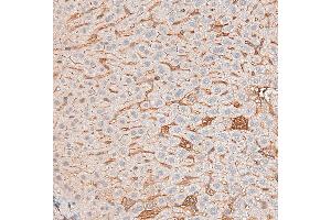 DF6386 at 1/200 staining mouse liver tissue sections by IHC-P. (Caveolin-1 antibody  (N-Term))