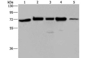 Western Blot analysis of A172, Hela and 293T cell, K562 cell and Human testis tissue using AGFG1 Polyclonal Antibody at dilution of 1:727 (AGFG1 antibody)