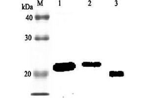 Western blot analysis using anti-RBP4 (rat), pAb (Biotin)  at 1:2'000 dilution. (RBP4 antibody  (Biotin))