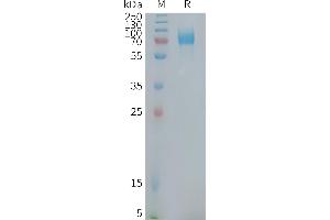 Human CD22(417-678) Protein, mFc Tag on SDS-PAGE under reducing condition. (CD22 Protein (AA 417-678) (mFc Tag))