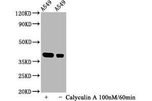 Western Blot Positive WB detected in A549 whole cell lysate(treated with Calyculin A or not) All lanes Phospho-NFKBIA antibody at 1. (Recombinant NFKBIA antibody  (pSer32))