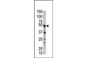 Western Blotting (WB) image for anti-GPI-anchor transamidase (GPI8) (C-Term) antibody (ABIN357726) (PIGK antibody  (C-Term))