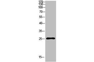 Western Blot analysis of NT28 cells using Antibody diluted at 500. (HSP27 antibody  (AA 60-100))