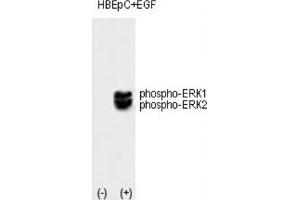 Western Blotting (WB) image for anti-Mitogen-Activated Protein Kinase 1/3 (MAPK1/3) (pThr202), (pTyr204) antibody (ABIN3001885) (ERK1/2 antibody  (pThr202, pTyr204))