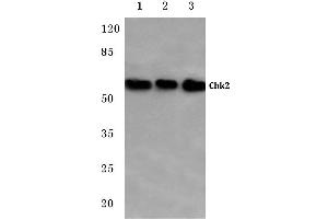 Western blot (WB) analysis of Chk2 antibody at 1/500 dilution (CHEK2 antibody)
