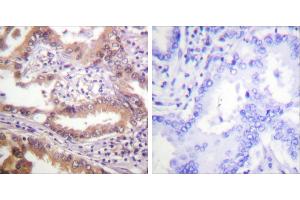 Peptide - + (IRF3 antibody  (Ser385))