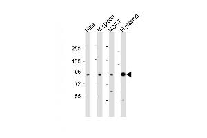 All lanes : Anti-GSN Antibody (C-term) at 1:1000-1:2000 dilution Lane 1: Hela whole cell lysates Lane 2: mouse spleen lysates Lane 3: MCF-7 whole cell lysates Lane 4: human plasma lysates Lysates/proteins at 20 μg per lane. (Gelsolin antibody  (C-Term))