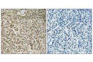 Immunohistochemistry (IHC) image for anti-Ubiquitin A-52 Residue Ribosomal Protein Fusion Product 1 (UBA52) (C-Term) antibody (ABIN1850644) (UBA52 antibody  (C-Term))