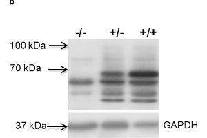 Western Blotting (WB) image for anti-Growth Hormone Receptor (GHR) (AA 101-200) antibody (ABIN671481)